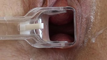 Amateur Medical Fetish Video Featuring A Milf Using A Speculum For Masturbation.